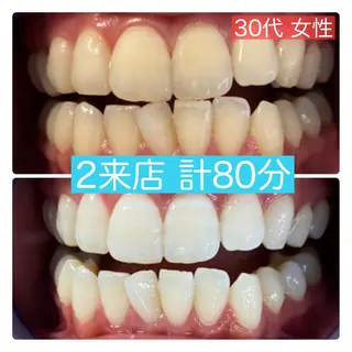 PLATINUM Beauty 横浜店所属・ホワイトニングルーム 横浜店のその他イメージ