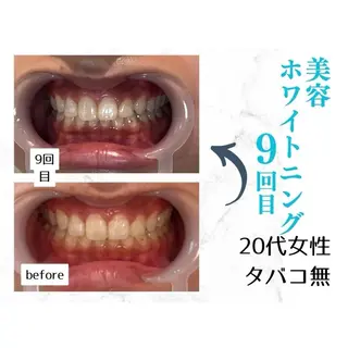 ホワイトニングサロン le  canonのその他イメージ