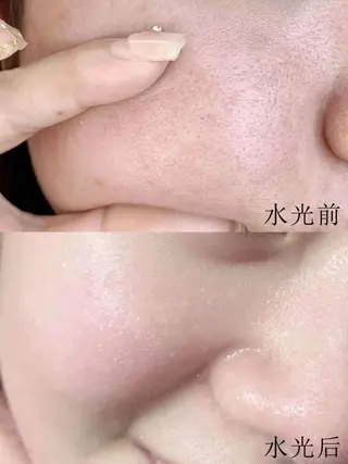 マツエク・マツパ aliaハイフ&水光ジェットサロン所属・aliaハーブ水光店 エステティシャン募集のエステ・リラクイメージ