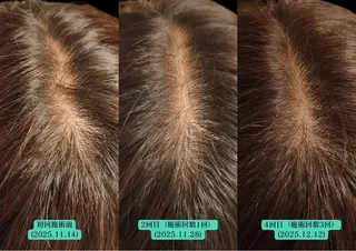 美容とカラダの鍼灸 サロン やなけんのエステ・リラクイメージ