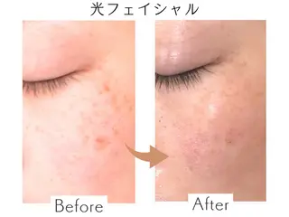 プライベートサロン Belle(ベル)のエステ・リラクイメージ