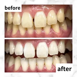 LBSホワイトニング 🌐渋谷店 河内のエステ・リラクイメージ