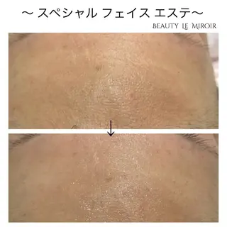 ビューティー ミロワールのエステ・リラクイメージ