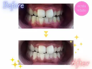 エクシア町田店所属・miku .のエステ・リラクイメージ