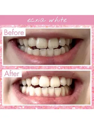 セルフホワイトニング エクシア武蔵小杉店のその他イメージ