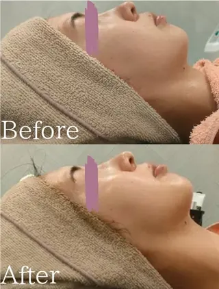 美肌脱毛＆小顔・フェ イシャル【SONA】のエステ・リラクイメージ