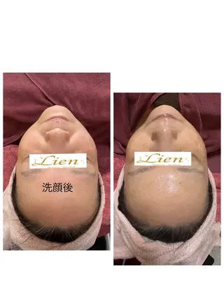 Lien オーナー　山口智嘉のエステ・リラクイメージ