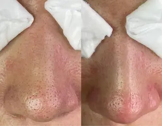 大久保 里奈のエステ・リラクイメージ