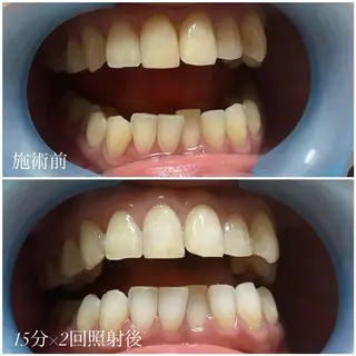 ネイル/耳つぼ /新ホワイトニングのネイルデザイン