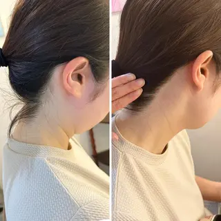 うなじ脱毛/美肌脱毛 LABELのエステ・リラクイメージ