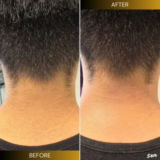 メンズ シュガーリング/脱毛 EARLS三軒茶屋のエステ・リラクイメージ