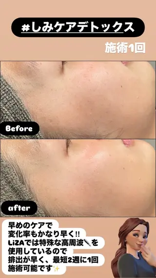 LiZA エステティックサロンのエステ・リラクイメージ