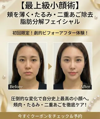 【歴13年】劇的小顔 D rマジックタッチのエステ・リラクイメージ