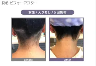 トータルビューティー サロンCherie2のエステ・リラクイメージ