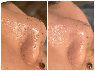 お肌と歯のサロン　Sona Mior所属・藤井 ののみのエステ・リラクイメージ