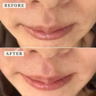 【産毛・眉毛ケア＆肌質改善サロン】＊BiBi＊beautysalon所属・眉･産毛専門BiBi 糸脱毛スレッティングのエステ・リラクイメージ