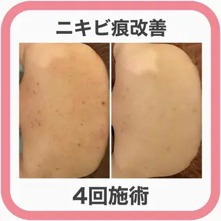 ミディアム カラー パーマ ヘアアレンジ メンズ キッズ ネイル マツエク・マツパ ニキビ・肌質改善専門 ♡人生が変わるサロンのエステ・リラクイメージ