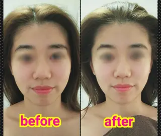 バスト&フェイシャル 専門店リラーシェのエステ・リラクイメージ