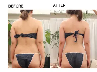 RENsalon大阪 体質改善リトリートのエステ・リラクイメージ