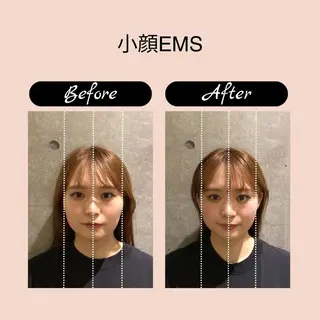 恵比寿/小顔/矯正 美容整体師⭐︎Aiのエステ・リラクイメージ