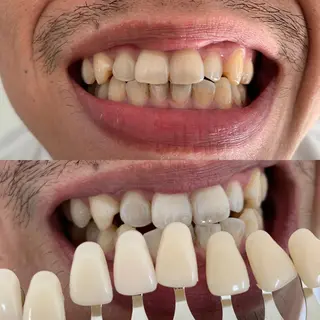 217whitening  room所属・217 ホワイトニングルームのエステ・リラクイメージ