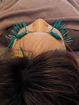 乃々鍼灸・整体院　表参道所属・乃々鍼灸整体院　植木 　【美容鍼/整体】のエステ・リラクイメージ