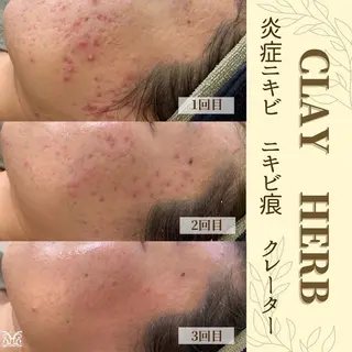 デトックス専門サロン ココシュエットのエステ・リラクイメージ