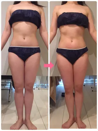 ロング カラー パーマ ヘアアレンジ メンズ キッズ ネイル マツエク・マツパ ‍痩身＆ボディ 結果出し🌟丹野のエステ・リラクイメージ