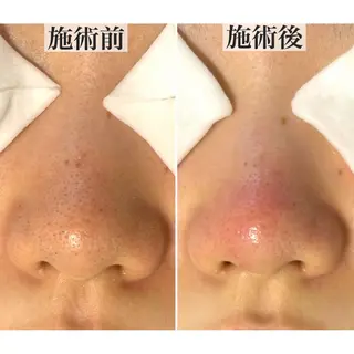 NiNy所属・毛穴ケア専門店 NiNyのエステ・リラクイメージ