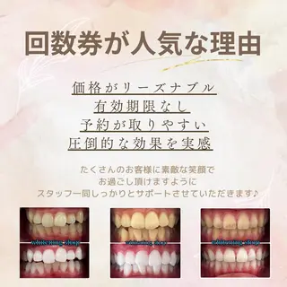 ホワイトニングショップ時津店所属・ホワイトニング ショップ長崎時津店のその他イメージ