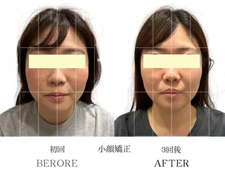 小顔・ニキビ・肌管理 TERN 南草津店のエステ・リラクイメージ