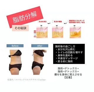 ユニセックスエステサロンUniclear所属・痩身&フェイシャル Uniclearのエステ・リラクイメージ
