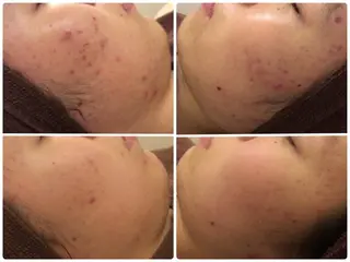 ミディアム カラー パーマ ヘアアレンジ メンズ キッズ ネイル マツエク・マツパ ニキビ・肌質改善専門 ♡人生が変わるサロンのエステ・リラクイメージ