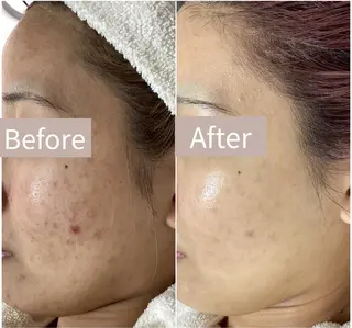 都度払い 肌質改善専門サロンのエステ・リラクイメージ