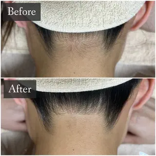 脱毛専門サロン BELFINE恵比寿のエステ・リラクイメージ