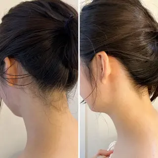 うなじ脱毛/美肌脱毛 LABELのエステ・リラクイメージ