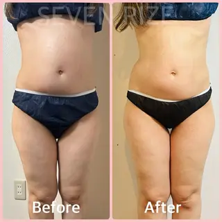 SevenRoom 玉置のエステ・リラクイメージ