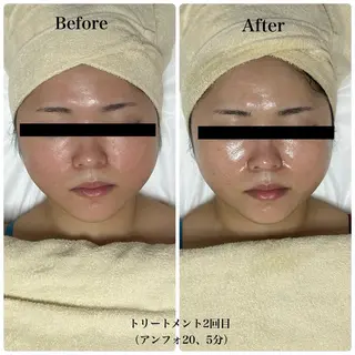 脱毛サロン エクボスタッフのエステ・リラクイメージ