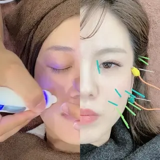 美容鍼×小顔×姿勢× ブライダル整体のエステ・リラクイメージ