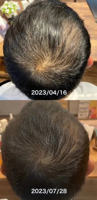 bellissimo 【ベリッシモ】所属・ちひろ　痩身/ハーブ bellissimoのエステ・リラクイメージ