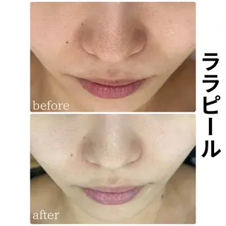 ULT ultimateskin所属・ULT ウルトのエステ・リラクイメージ