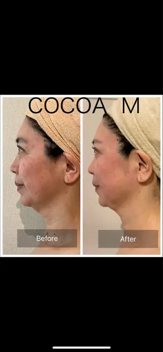 よもぎ蒸しCOCOA M（ココアエム）のその他イメージ