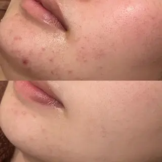 触れたくなる モテ肌へ...❤︎のエステ・リラクイメージ