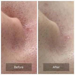 one day所属・肌質改善ハーブサロン ALA原宿のエステ・リラクイメージ