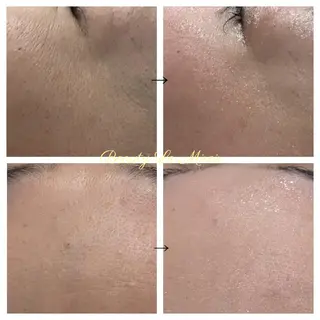 ビューティー ミロワールのエステ・リラクイメージ