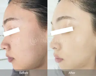 Honey Moom所属・Honey Moomのエステ・リラクイメージ