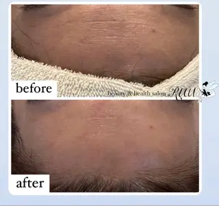 【頭痛、睡眠改善】 salon RUUのエステ・リラクイメージ