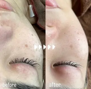 Rifuro 勝田台エステ所属・Rifuro勝田台 ララピール・毛穴洗浄のエステ・リラクイメージ