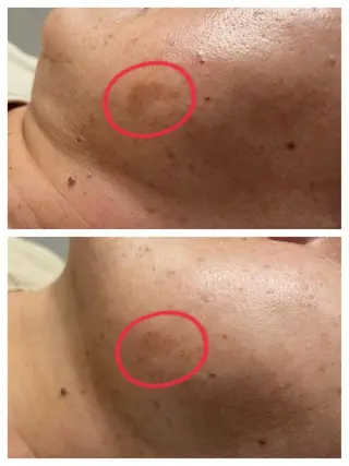 the  moons.所属・伊藤たから☾ the moons.のマツエク・マツパデザイン