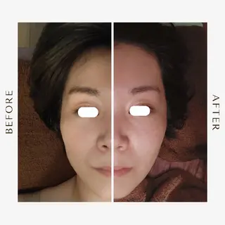 鍼灸サロンmiyabi所属・美容鍼×エステ　鍼灸 サロンmiyabiのエステ・リラクイメージ